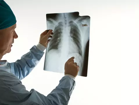 X-ray examination in pregnancy