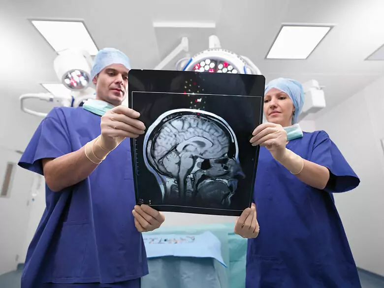 Brain aneurysm