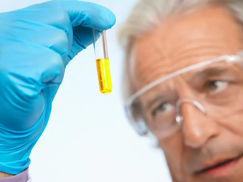 Neuroendocrine tumours and daily urine collection