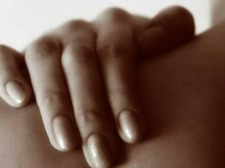 Ringworm - causes, symptoms, diagnosis, treatment 