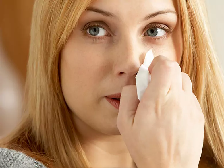 Nosebleeds in pregnancy - causes, symptoms, diagnosis, treatment