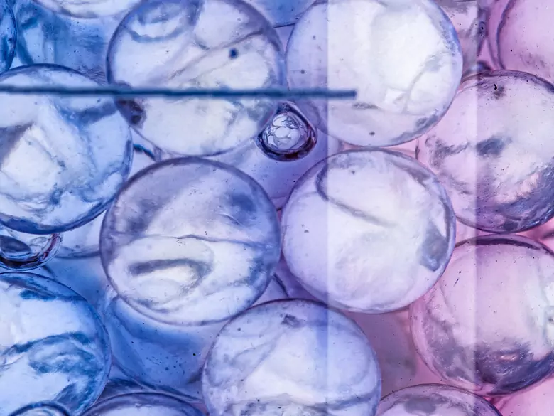 Corrosive acid poisoning - causes, symptoms, diagnosis, treatment