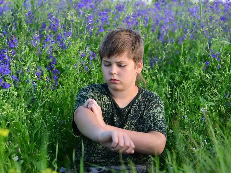 Contact allergy in children: studies on factors that may cause it