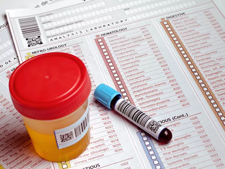 Unusual urine odour and various diseases