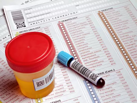 Unusual urine odour and various diseases