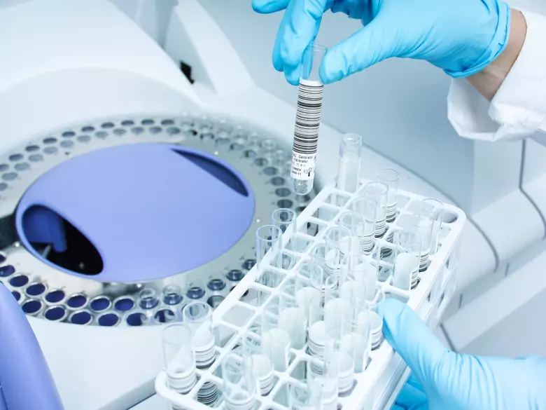 Infertility - what tests to perform?