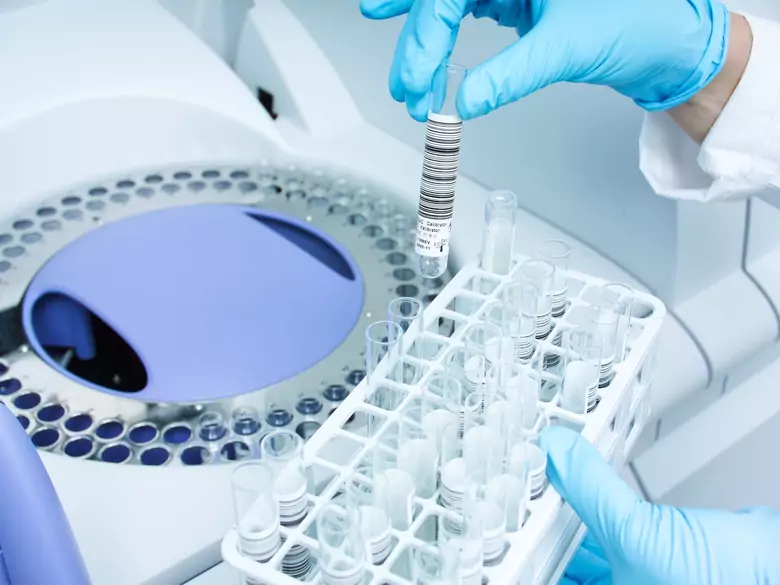 Can a saliva test detect pancreatic cancer?