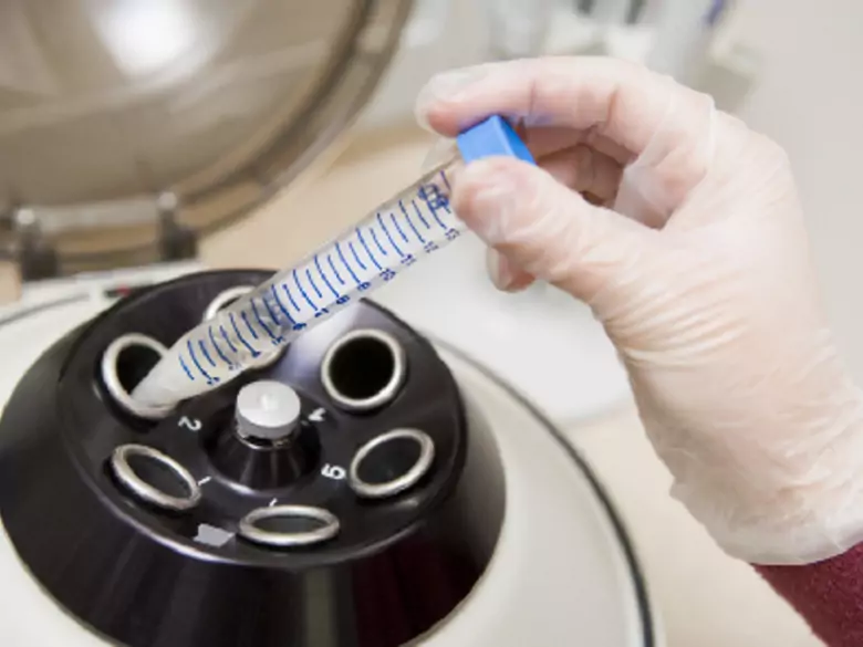 Cervical cancer - risk factors and prevention