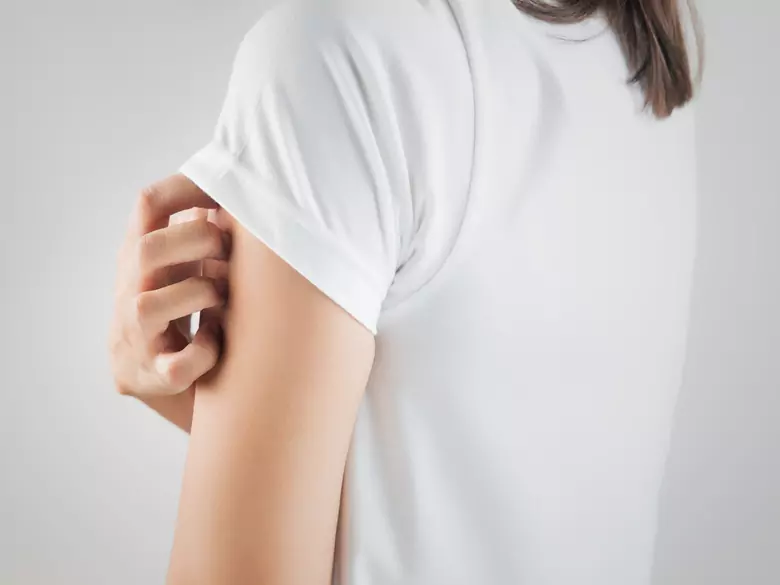 How to deal with excessive skin seborrhoea?