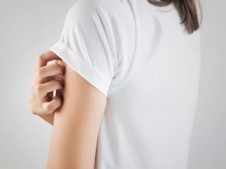 How to deal with excessive skin seborrhoea?