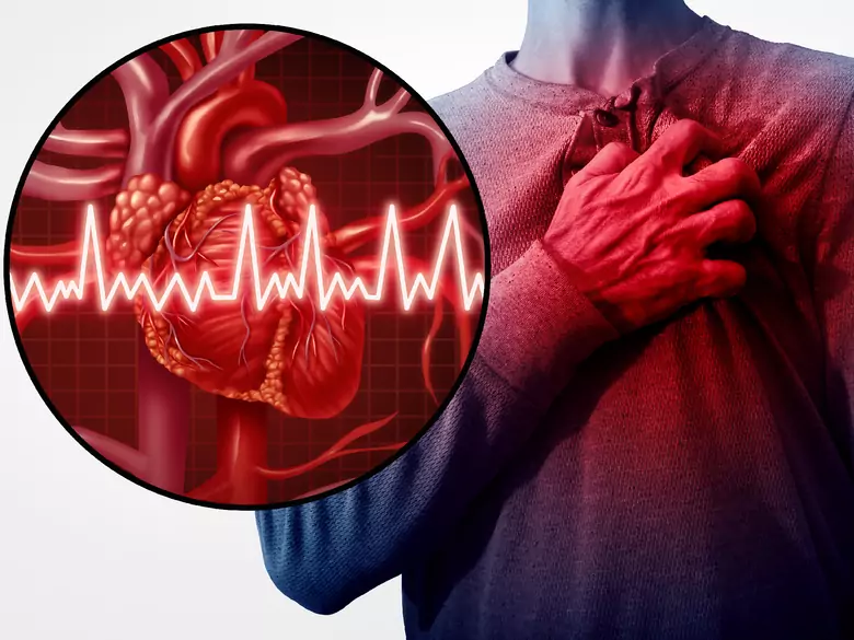 Vitamin D and cardiovascular disease