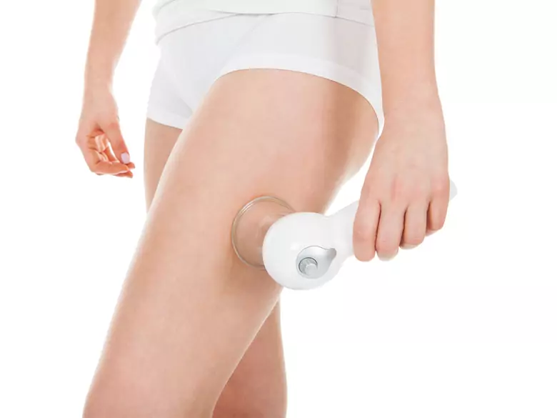 Fight cellulite with laser