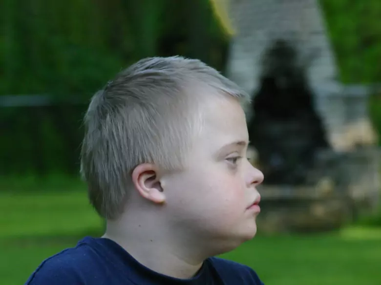 Definition and types of mental retardation