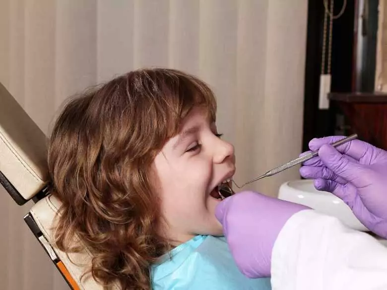 Malocclusion in children - causes, symptoms, diagnosis, treatment