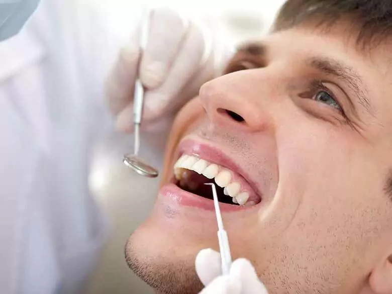 What is tooth sandblasting?