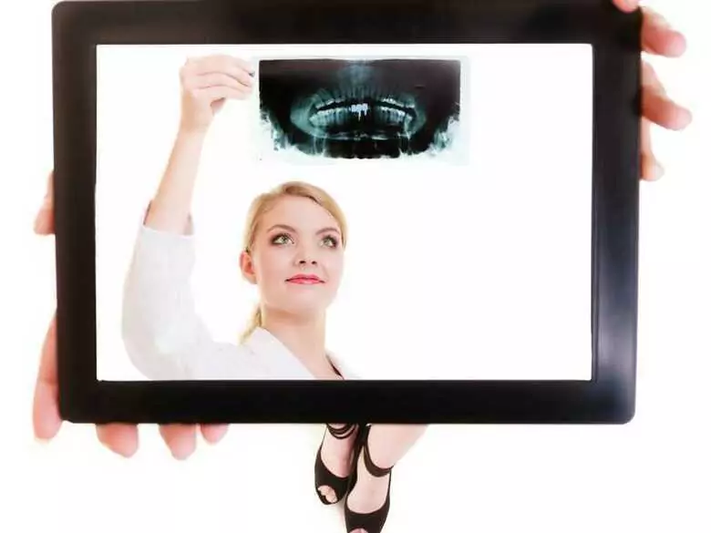 Exposed tooth necks - causes, symptoms, diagnosis, treatment