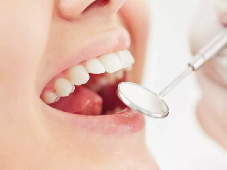 Teeth grinding - causes, symptoms, diagnosis, treatment