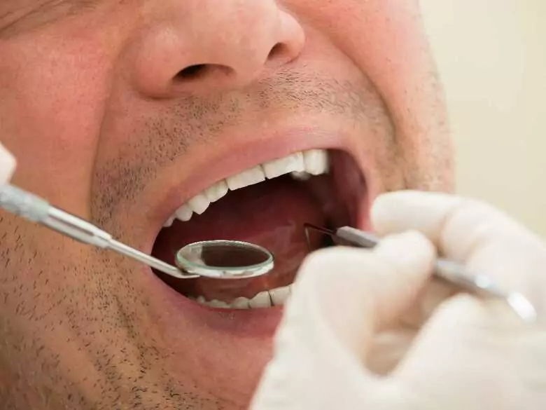 Drillless tooth treatment