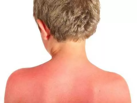 After just 30 minutes of sun exposure, your skin can be red! This is affected by the ozone layer and UV levels