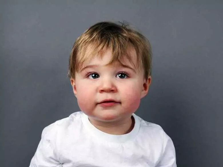 Does diet help alleviate the symptoms of atopic dermatitis?