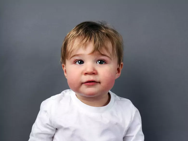 Does diet help alleviate the symptoms of atopic dermatitis?