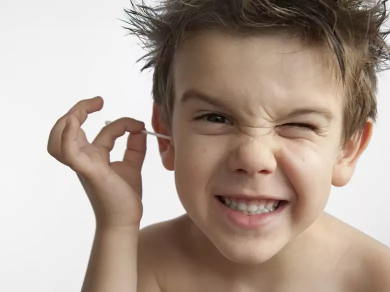 Exudative otitis media