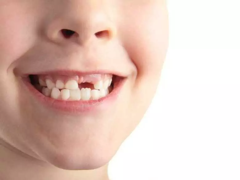 Snacking between meals puts children at risk of caries and obesity