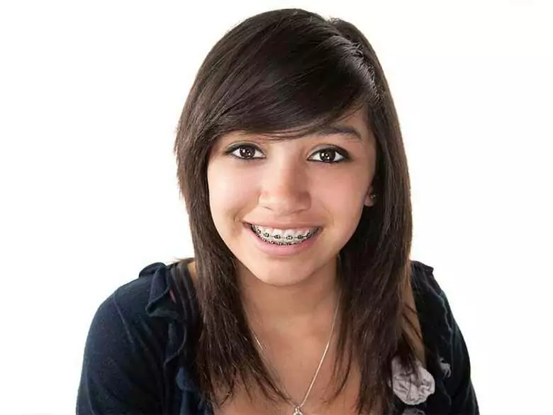 Braces - all about braces