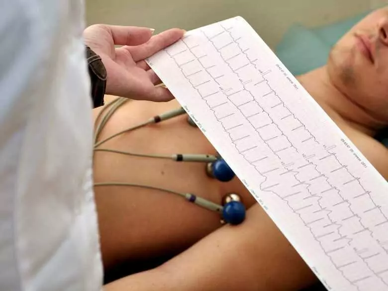 What is an ECG test?