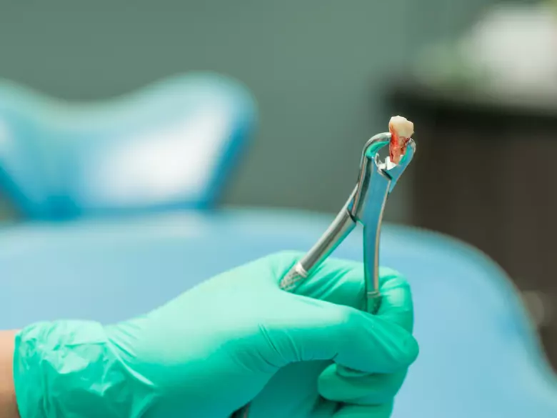 When is an emergency tooth extraction necessary?