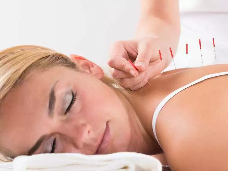 What are the benefits of acupuncture and other alternative therapies?
