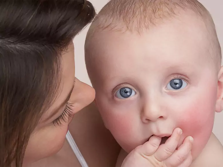 Problems of children with neuromuscular diseases