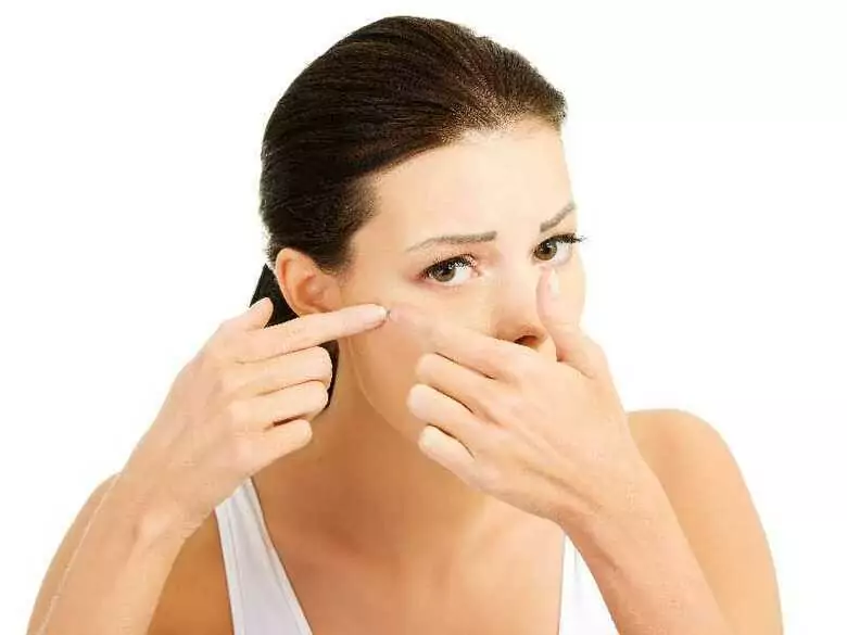 Hormone therapy in women with acne