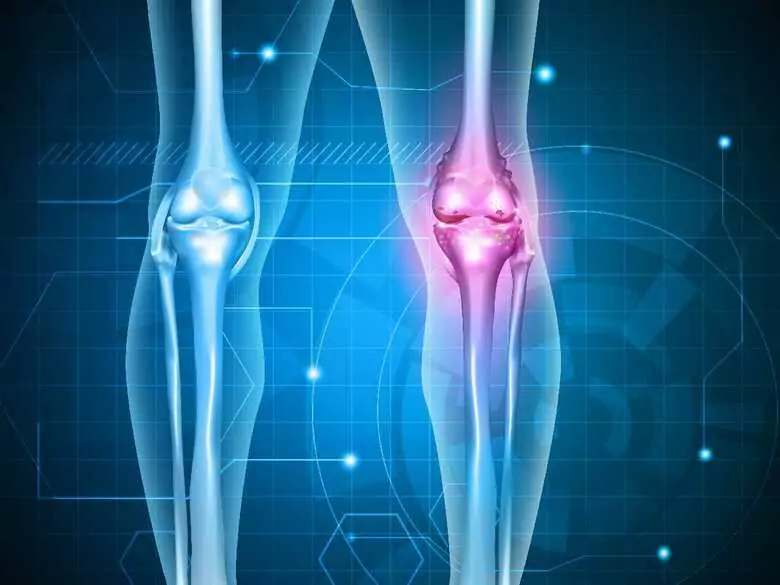 Ewing's sarcoma - causes, symptoms, diagnosis, treatment