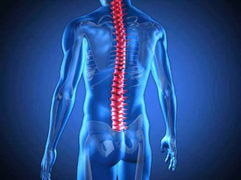 Spina bifida