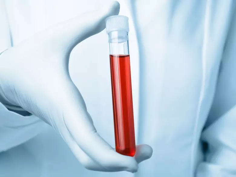 DHEA - the super hormone