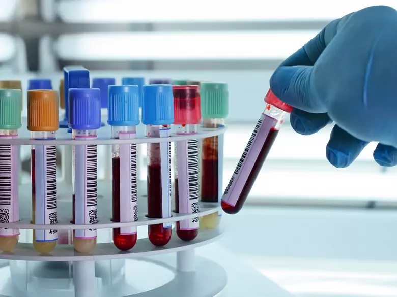 Which blood tests during pregnancy?