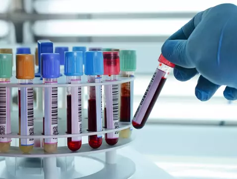 Proper nutrition in anaemia