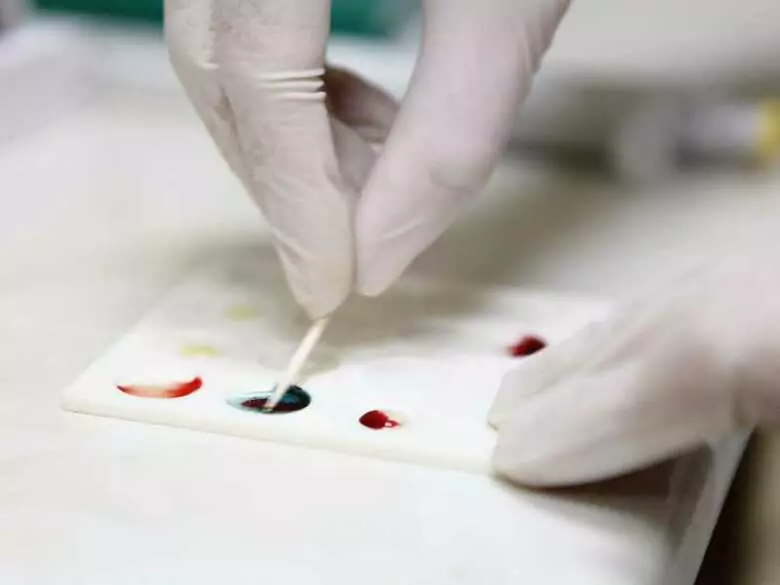 Cerebral malaria - the most dangerous form of malaria