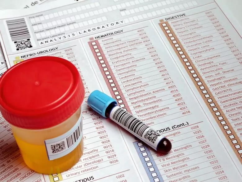 What does an elevated uric acid level mean?