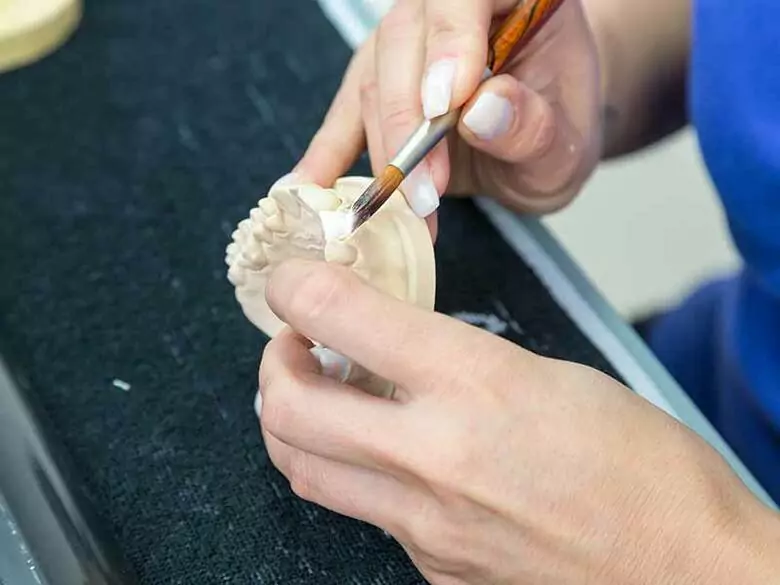 Removable partial dentures