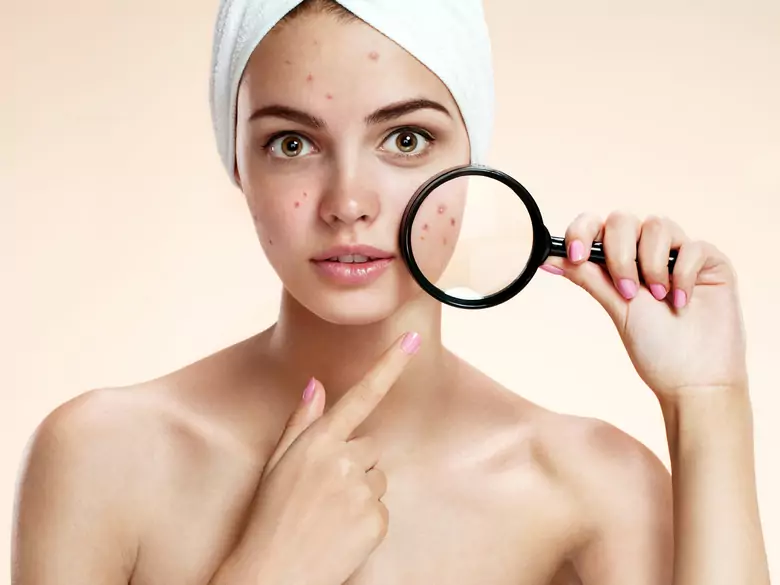 Cutaneous manifestations of diseases with neurological symptoms