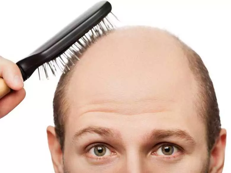 Steroids? Instead of sculpting, infertility and baldness