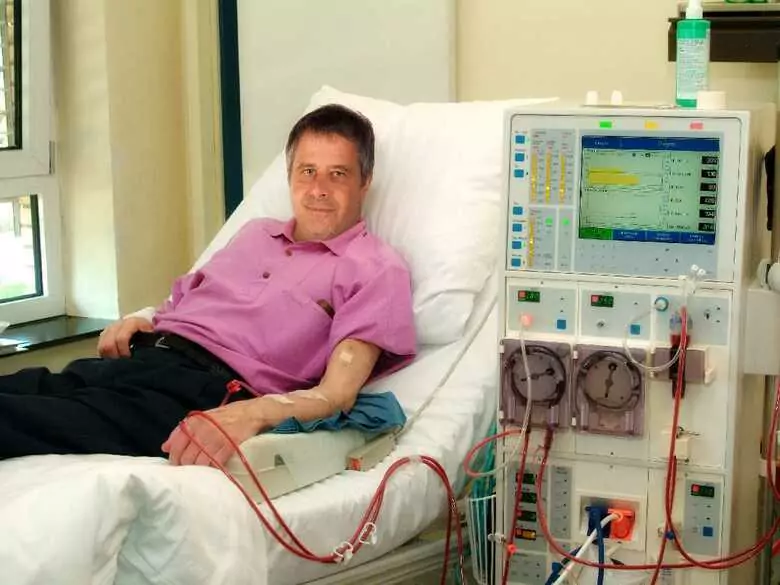 Czech doctors have helped explain the cause of a rare kidney disease