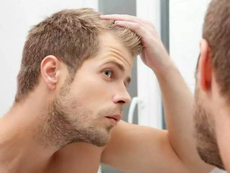 Oily scalp