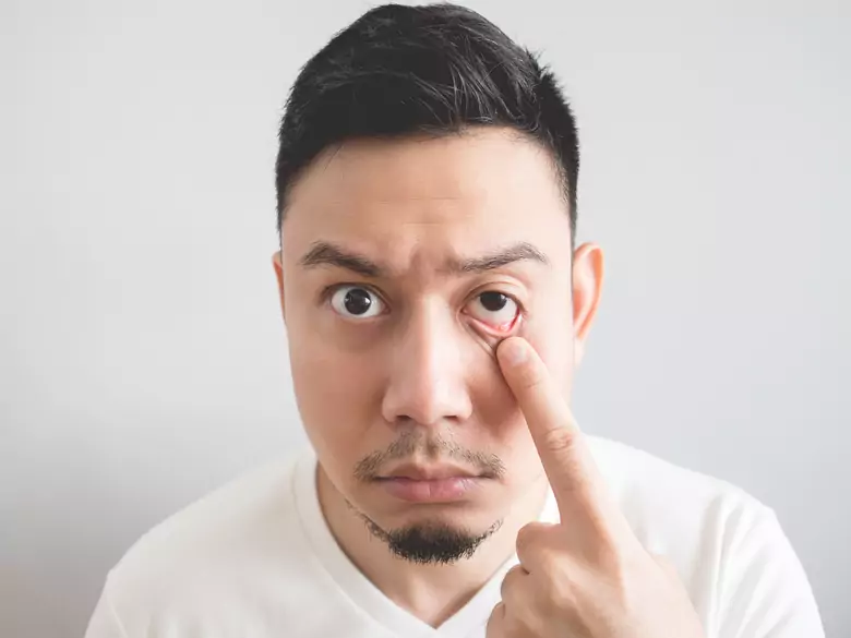 What could be the causes of twitching eyelids?