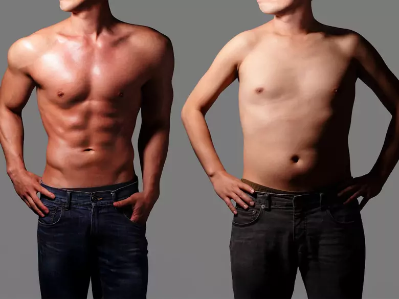 Dysmorphophobia and plastic surgery