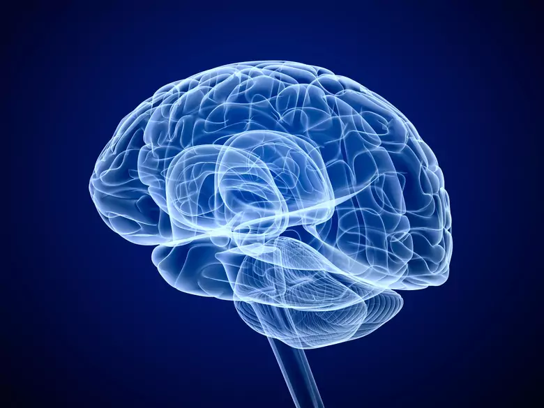 Stroke - symptoms, how to recognise
