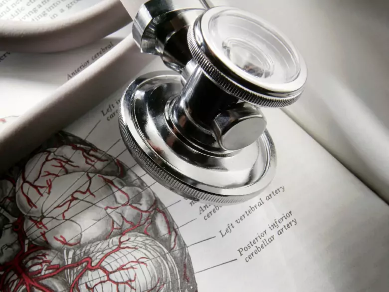 Vascular diseases of the brain
