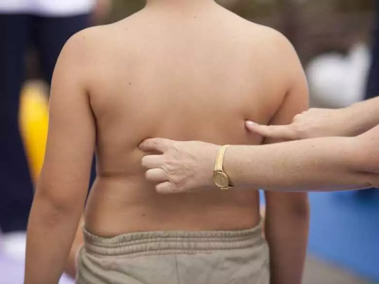 Risk factors for the development of obesity in children: a study of a group of 7-year-olds